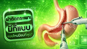 ผ่าตัดกระเพาะ มีกี่แบบ