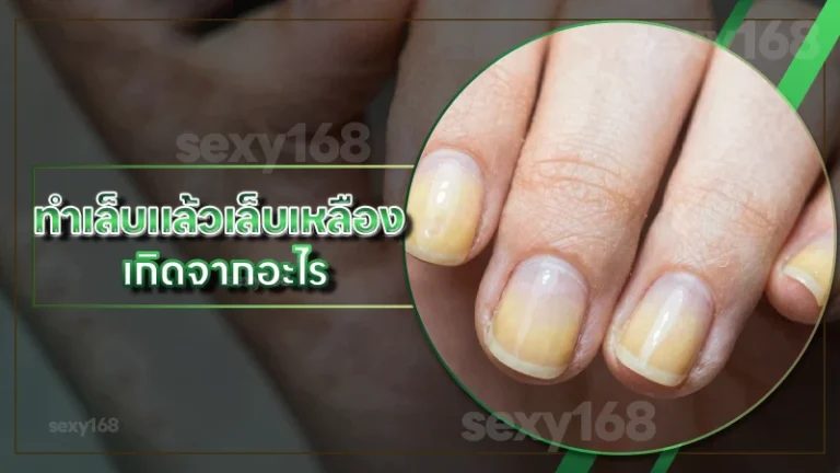 ทำเล็บแล้วเล็บเหลือง เกิดจากอะไร